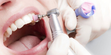 Профессиональная гигиена полости рта (чистка зубов)